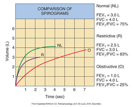 Normal Spirometry Chart